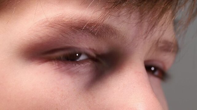 Close-up of a child's eyes and eyebrows, boy blinking and staring at the lens.