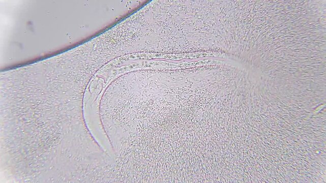 Nematode moving with bacteria and sand particles under 100x bright field microscopy. 4K scientific microscopy footage.