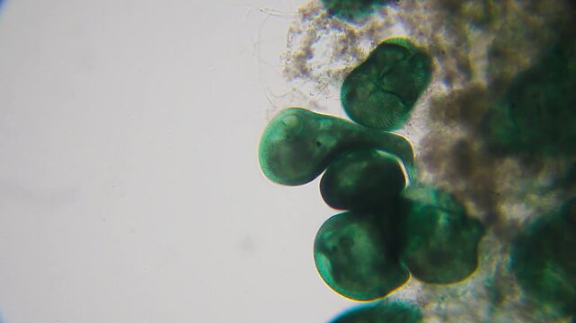 Colony of Stentor ciliates attached to substrate under 100x bright field microscopy. 4K scientific microscopy footage.