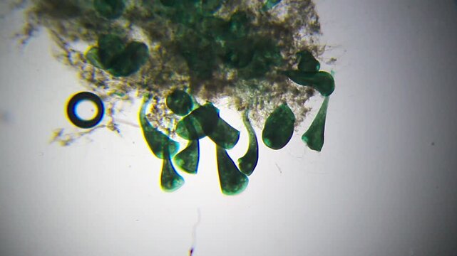 Colony of Stentor ciliates attached to substrate under 40x bright field microscopy. 4K scientific microscopy footage.