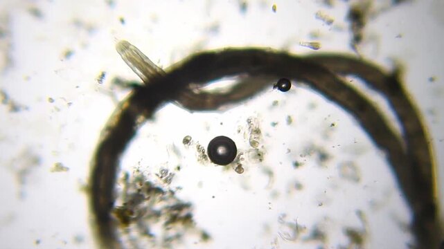 Two annelid worms intertwining with rotifers nearby under 40x bright field microscopy. 4K scientific microscopy footage.