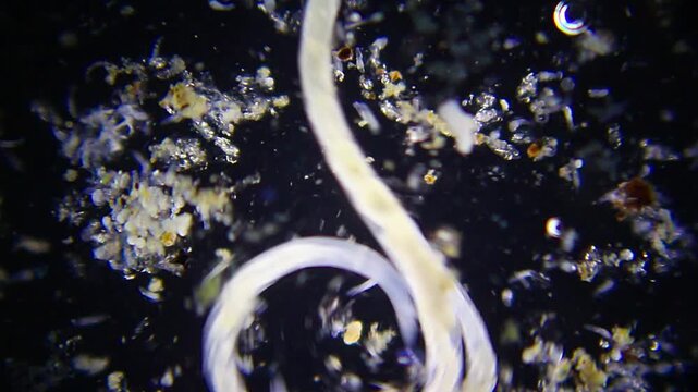 Two annelid worms intertwining with rotifers nearby under 40x dark field microscopy. 4K scientific microscopy footage.