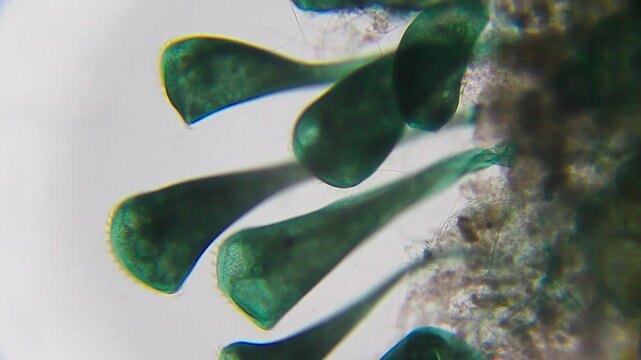 Colony of Stentor ciliates attached to substrate under 100x bright field microscopy. 4K scientific microscopy footage.