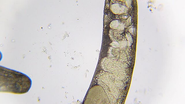 Segmented annelid worm showing body structure in panoramic view under 100x bright field microscopy. 4K scientific microscopy footage.