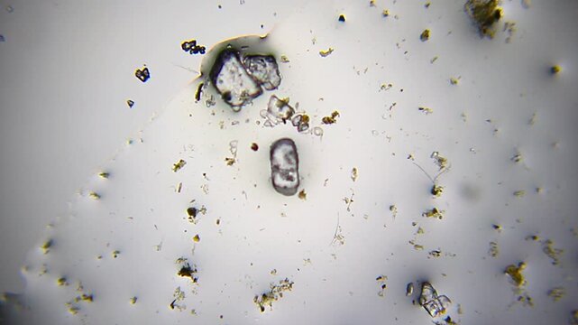 Nematode exhibiting bending and coiling locomotion around salt particles under 40x bright field microscopy. 4K scientific microscopy footage.