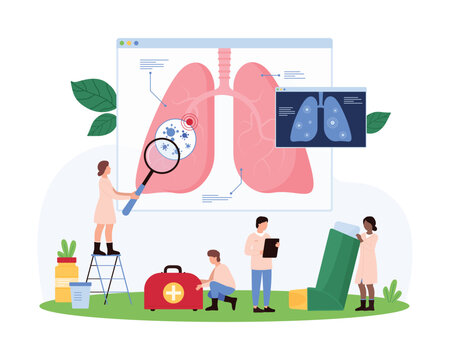 Diagnosis and treatment of lung diseases, pulmonology, respiratory system inspection in hospital. Tiny pulmonologists check patients xray of lungs with magnifying glass cartoon vector illustration