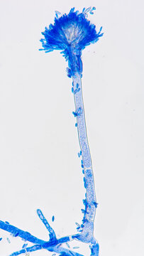 Gliocephalotrichum bulbilium isolated from rotten rose apple in Indonesia. Stained using lactophenol cotton blue. Stacked from 19 images.