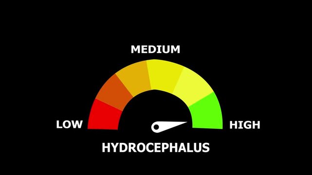 Conceptual Gauge Animation with a Needle Pointing to Mid-Range, Labeled Low, Medium, and High with Color-Coded Segments Indicating a Hydrocephalus Level on Black Background.
