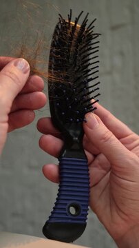 Vertical video. Hair loss concept. Female hands holding hairbrush with loose hair after combing