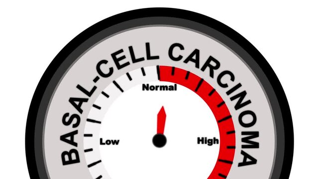 Basal-cell carcinoma gauge with needle pointing towards high on a white background Keywords: gauge, meter, basal-cell carcinoma, indicator, dial, measurement, scale, cancer, skin, health, medical