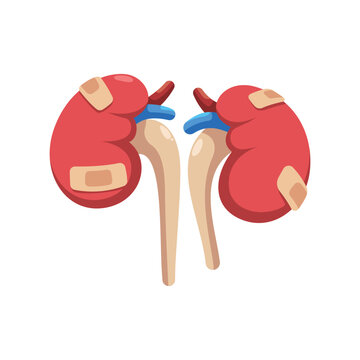 Unhealthy human kidneys with bandages vector, renal disease and kidney failure concept, medical recovery and treatment illustration.