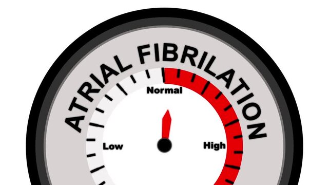 Atrial Fibrillation Level Meter Showing Low Reading On White Background afib heart rhythm disorder