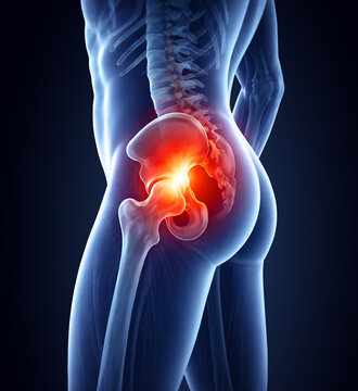 Inflamed hip joint close-up illustration 