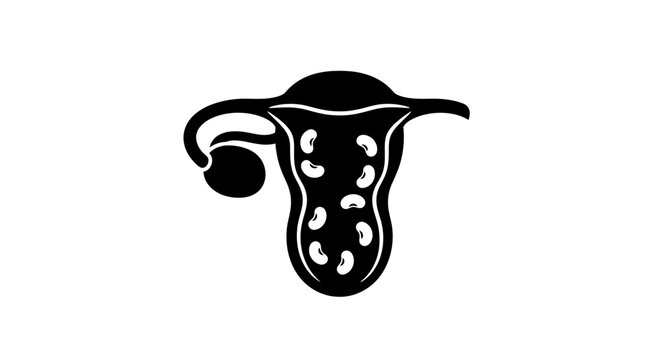 Uterus and Ovary Anatomical Illustration.
