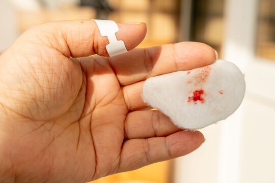 Tiny cut on fingertip, Close up injured thumb with bleeding skin, splinter wound on finger detail, painful hand injury, medical first aid, hygiene awareness, personal care, everyday accident