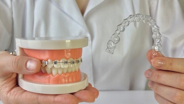 A hand holds a clear dental aligner next to a model of teeth with braces. Choosing a bite straightening option 