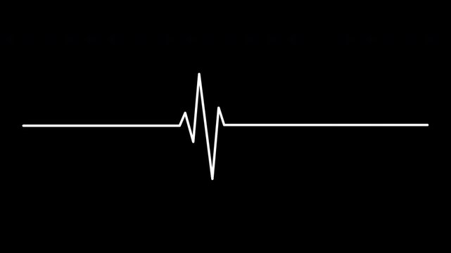 Heartbeat flatline on black background with spike, suitable for medical presentations, cardiology articles, healthcare websites, heart health graphics.