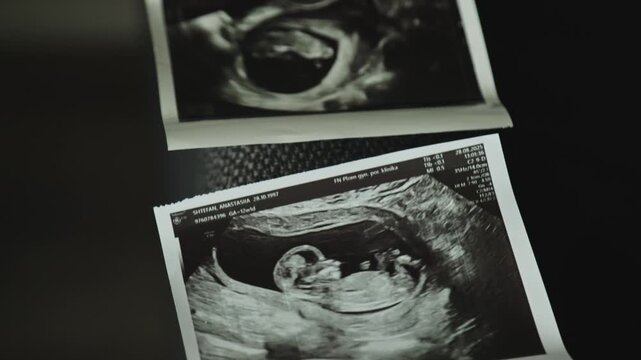 Ultrasound scan photos of a fetus next to blue baby booties. Represents the joy and anticipation of pregnancy and the upcoming arrival of a child. Ideal for pregnancy announcement content.