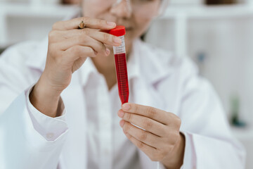 Female scientist wearing safety goggles holding a blood sample tube in laboratory, examining...