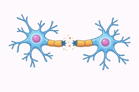 Illustration of two neurons with a broken connection between their axons, symbolizing nerve damage