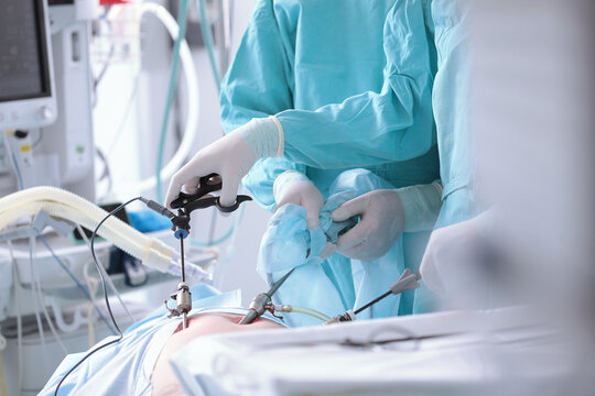 Surgeons perform laparoscopic surgery. Modern abdominal surgery. Surgical intervention through small holes. Penetration into abdominal cavity. Team of surgeons.