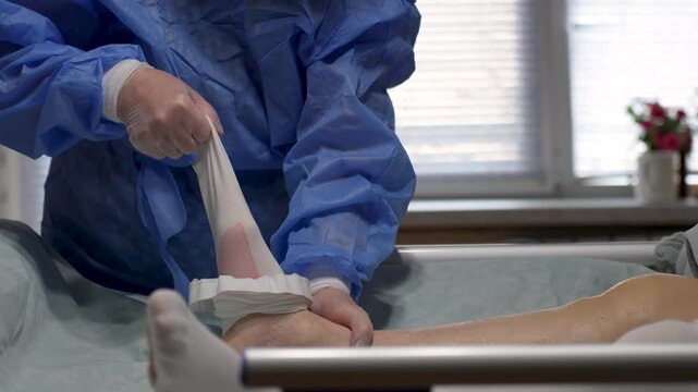 Doctor Removing Medical Compression Stocking from Patient. Healthcare professional removing removing anti embolism stocking from patient's leg after ankle surgery. Elderly care, caregiving and nursing