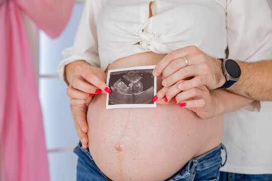 Close-up of hands holding ultrasound images over a pregnant belly. Pregnancy, ultrasound, and expecting parents. Diverse hands, intimate moment, pregnancy joy. Woman pregnancy, expecting baby concept.