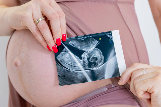 Close-up of hands holding ultrasound images over a pregnant belly. Pregnancy, ultrasound, and expecting parents. Diverse hands, intimate moment, pregnancy joy. Woman pregnancy, expecting baby concept.