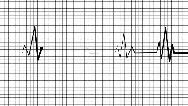 Stylized heartbeat line wave signal animation on graph paper