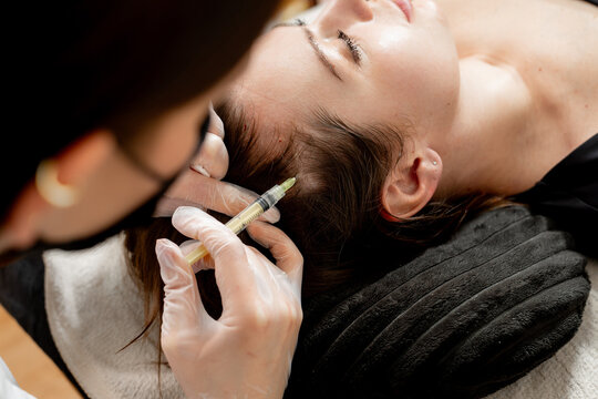 A lady receiving hair mesotherapy injections from a professional trichologist. Hair treatment in cosmetology with the help of injections for hair growth