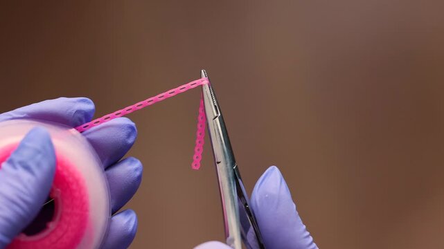 Detailed close up of purple orthodontic elastic ligature pulled from spool with specialized dental tool Doctor hands in gloves performing precise orthodontic procedure in clinical environment