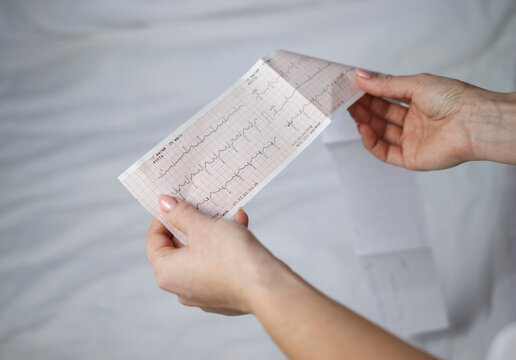 Hands with electrocardiogram paper showing heart rhythm data. Heart disease prevention and medical checkup theme.