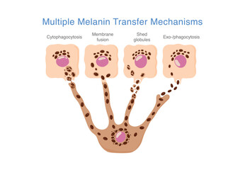 Multiple melanin transfer mechanisms between Melanocytes and Keratinocytes. Illustration about skin pigmentation processes associated with disorders as Melasma and other forms of hyperpigmentation.