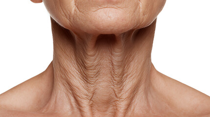 Fototapeta premium Close-up of a mature person's neck and chin, displaying prominent wrinkles and aged skin texture against a clean white background