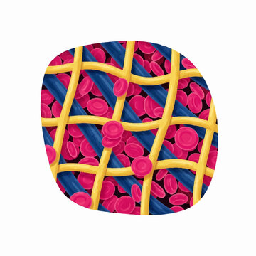 Microscopic view of blood clot with red blood cells trapped in fibrin mesh.