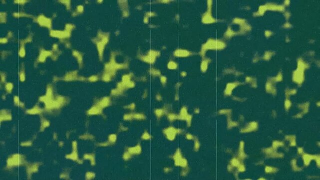 Dynamic dark teal and lime green abstract speckled fluid blotches with line.