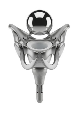 Hip prosthetic assembly with a mirror-polished metallic head and a matte textured titanium stem on a transparent background. medical technology concept