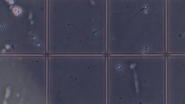 Human sperm cells moving in a grid under a microscope, revealing reproductive health and fertility studies in a laboratory.