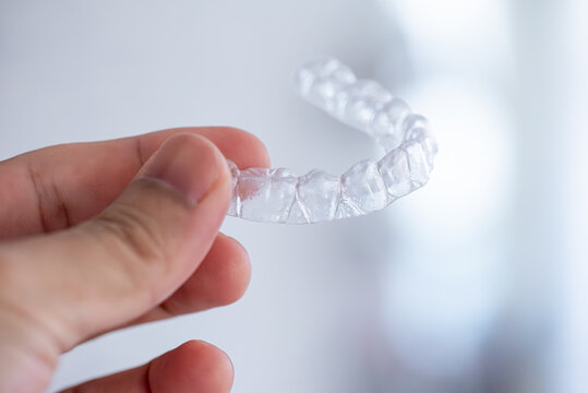  clear aligners device in the mouth on a white background. (invisalign)
