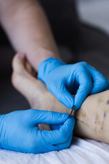 Doctor applies the stick on bandage to cover the small cuts after operation.