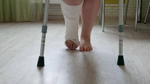Woman with broken leg in plaster cast using crutches while walking, rehabilitation after leg injury