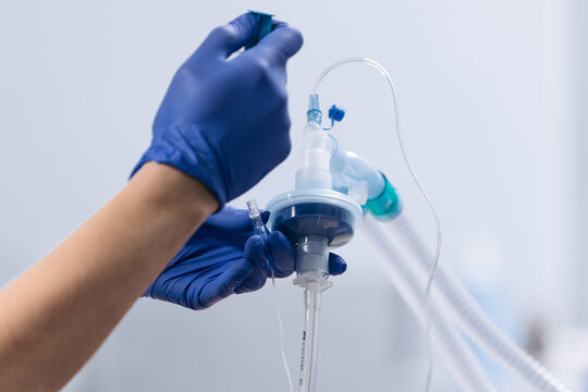An anesthesiologist performs tracheal intubation for surgical anesthesia. Modern concepts of anesthesia.