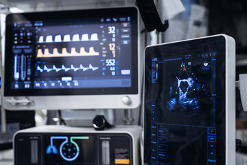 Fototapeta premium Medical monitoring equipment displaying vital signs and ultrasound images in a clinical setting, featuring multiple screens with graphs and data readouts