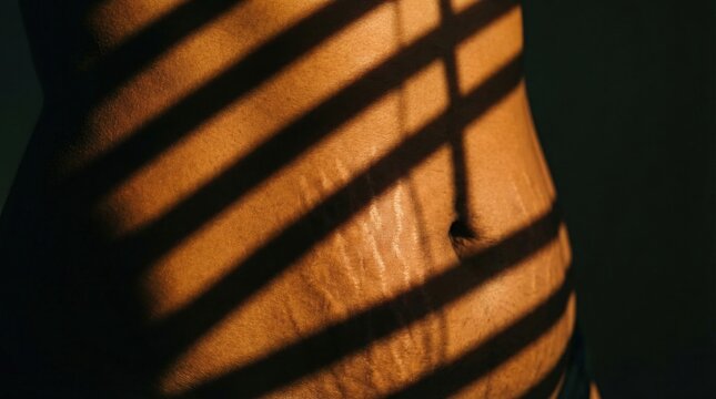 Close up view female abdomen showing stretch marks through window blind shadows. Artistic lighting highlights skin textures and body positivity. Suitable for skincare, dermatology, and wellness.