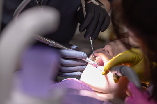 Dental professionals performing oral examination on patient with dental tools in a clinical setting, bright lighting and equipment visible