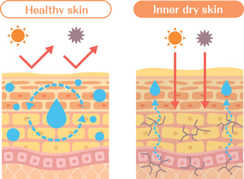 Inner dry skin structure diagram comparison