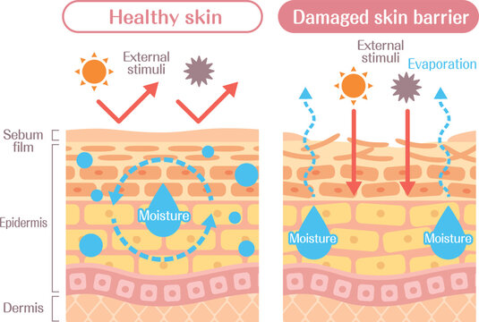 Skin barrier function diagram healthy vs damaged