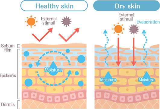 Dry skin structure diagram comparison
