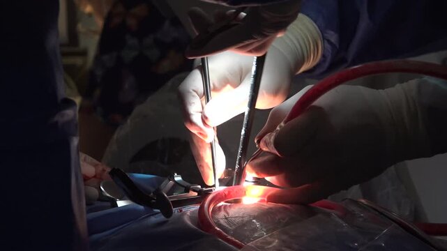 Precise surgical treatment for a cervical herniated disc. The surgeon relieves nerve pressure to restore mobility and quality of life, using modern medicine for a safe and full recovery.