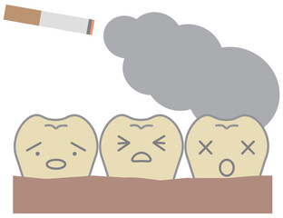歯茎の変色や黒ずみとヤニ汚れの歯の歯科イメージイラスト
